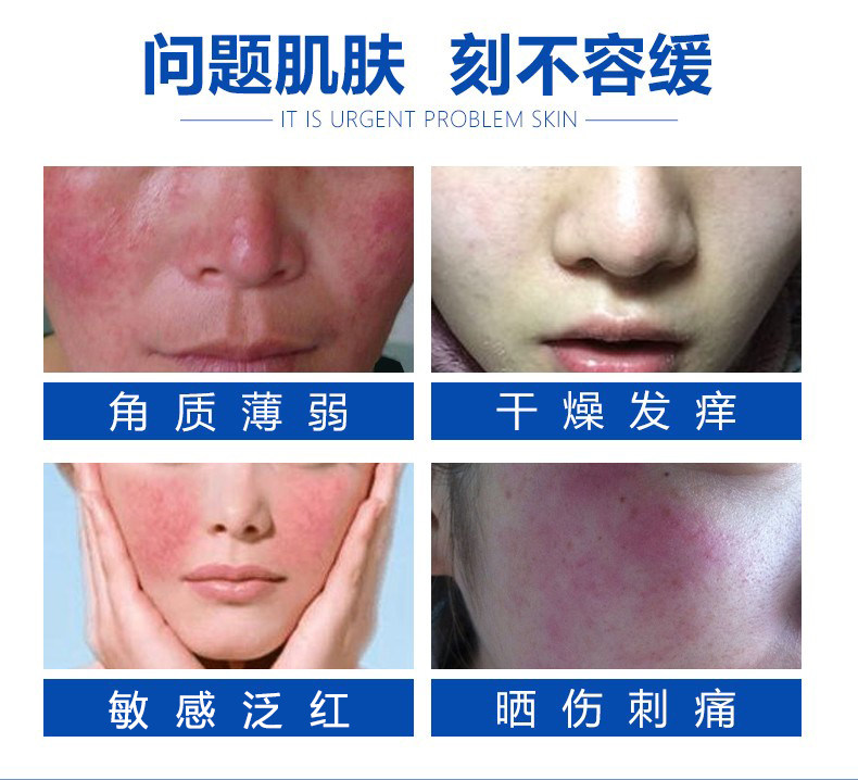 面部医用医美术后皮肤过敏敏感肌je 长寿大药房伤口敷料
