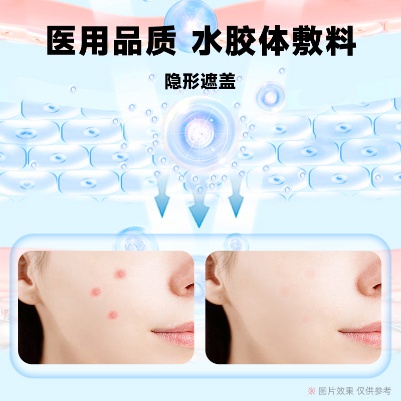 医用型痘痘贴修痘印复吸脓消人工皮炎星星祛豆豆隐形可化妆遮痘贴