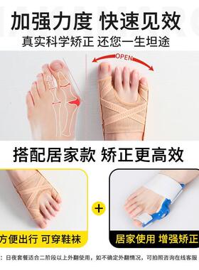 德国拇指外翻矫正小脚