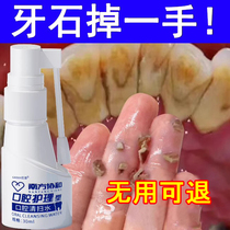 (Teeth White more beautiful) Farewell to Tooth Stones Dirt Dentition Yellow Tooth Scale Male And Female Universal Dental Yellow Instrumental Buy 3 Fat 5