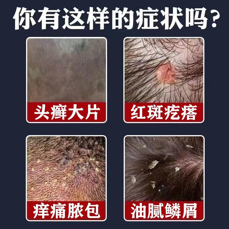  猪猪麦保健理疗