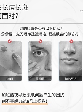 小奶油遮瑕/持久滋润遮瑕液/遮盖痘印.黑眼圈.雀斑.脸部斑点