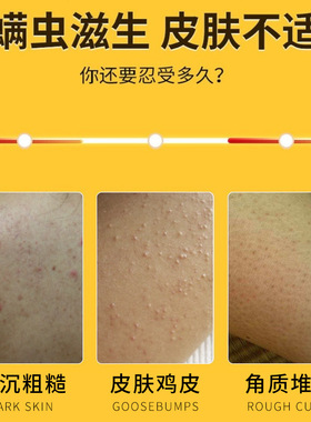 硫磺除螨沐浴露皮肤瘙痒流黄药皂儿硫磺洗澡液