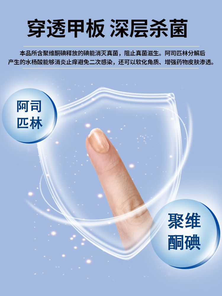 亮甲复方聚维酮碘4ml*4去液搽剂 楚蕴家庭医生大药房癣症