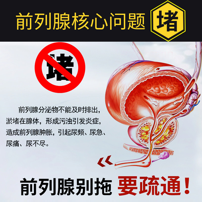 祖医堂缐宝慢性前列腺增生尿频 祖医堂李时珍膏药贴（器械）