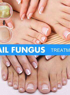 Foot Finger Liquid Anti Fungal Repair Serum Nail Removal Gel