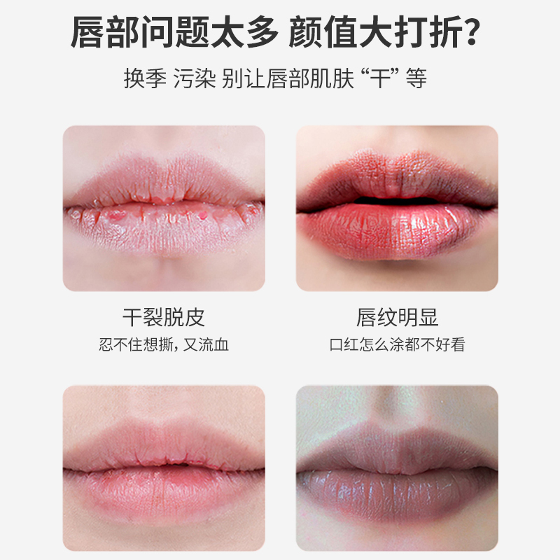 BLISTEX/百蕾适小蓝罐+小白管+保湿润唇膏防晒SPF15经典修护组合 - 图0