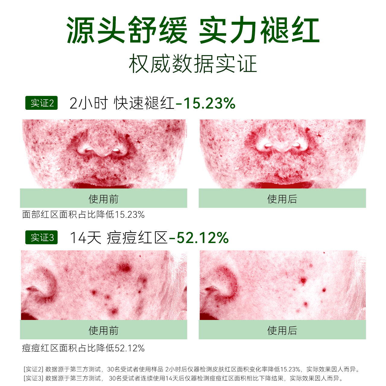 oncur安修泽40%油橄榄维稳精华液 ONCUR安修泽液态精华