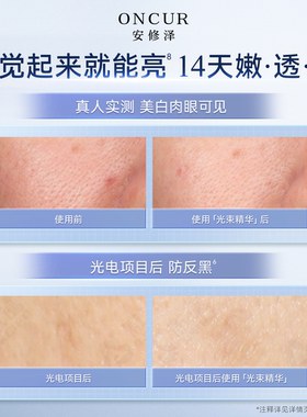 安修泽光束美白精华液