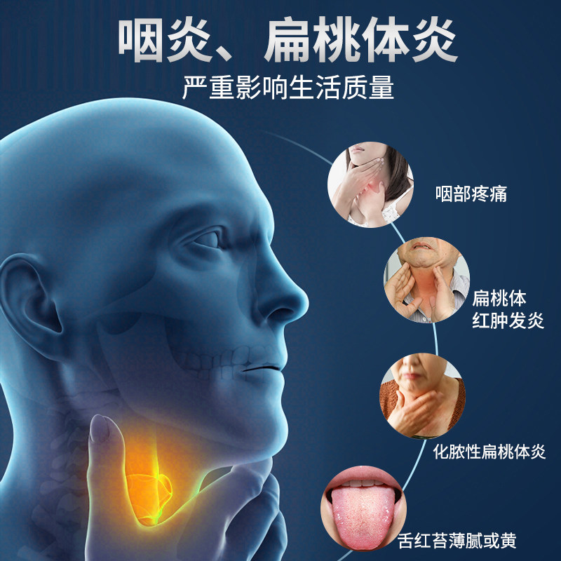 [祖医堂]咽扁康冷敷贴辅助治疗慢性 祖医堂施美达膏药贴（器械）