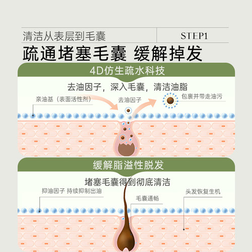 德国荨麻脂溢性脱发专用洗发水露控油蓬松炎敏感头皮清洁去屑止痒 - 图1