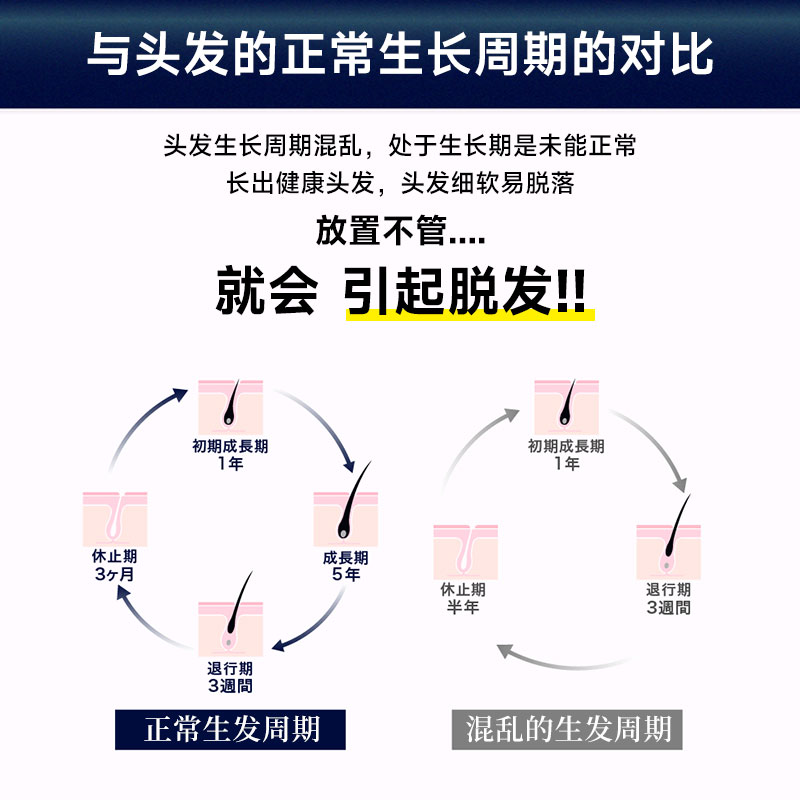 Reden生发剂防生发增发密发育发液女男脂溢性发际线护理生长舒缓 - 图2