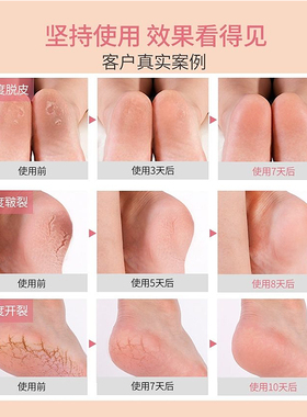 【日本原装】日本babyfoot经典足膜中码60分钟脚膜死皮脱皮角质