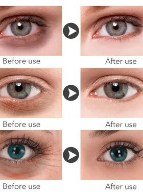 Micro-needle Eye Patch Hyaluronic Acid Anti-wrinkle Eye Mask