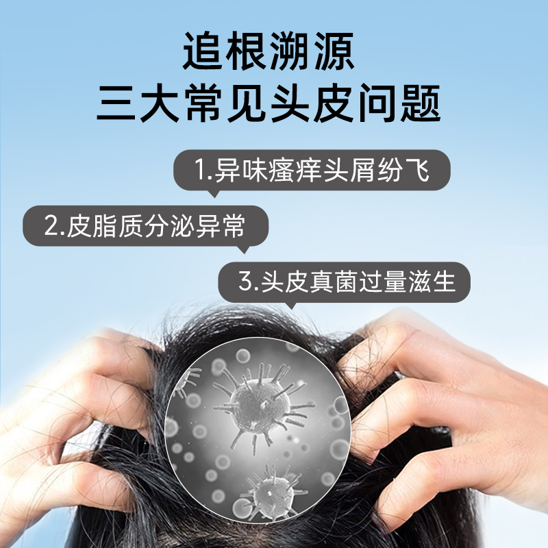 斯必申去屑蓬松洗发水135ml/瓶二硫化硒控油止痒液脂溢性皮炎