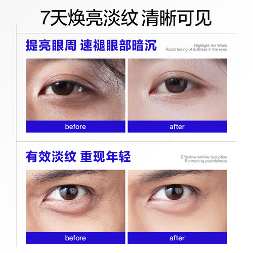 海洋至尊眼霜抗皱提拉紧致淡化细纹紧致眼周眼霜滋润紧致男士眼霜 - 图0