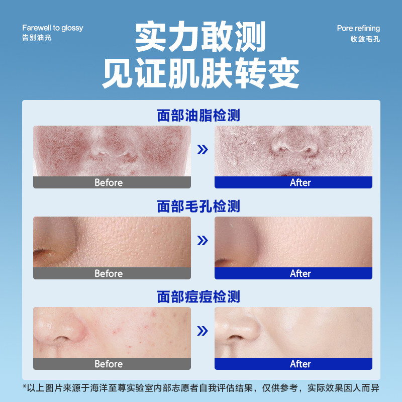 【b站独享特惠价】海洋至尊水能控油 海洋至尊男士护理套装