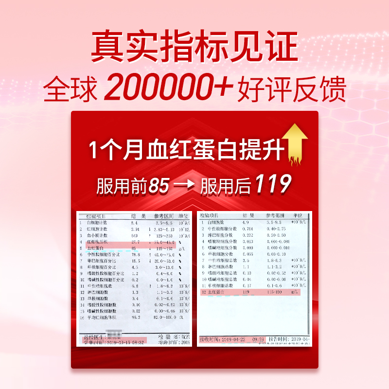 BECHI微囊脂质铁女人孕期营养孕妇草莓VC维生素叶酸补铁冲剂30包,淘宝优惠券,粉丝福利购,淘宝优惠卷