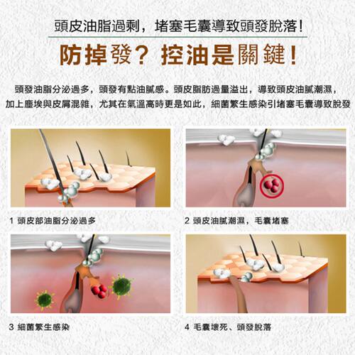 泰国at生姜洗发水Atreus护发无硅油控油止痒发去头屑男女孕妇通用 - 图2