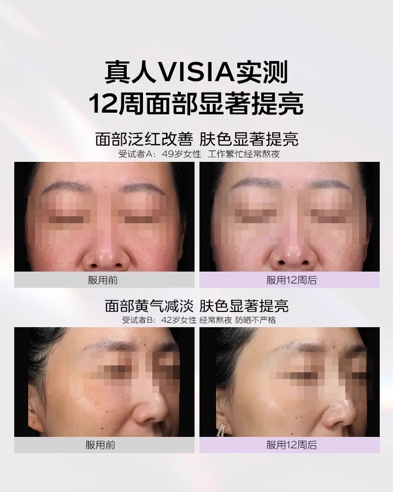 现货vida glow白月光胶囊VG滤镜焕白进口30粒谷胱甘肽烟酰胺 - 图0