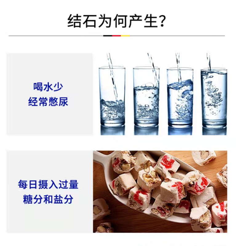 胆结石溶石化 飞纯度膏药贴（器械）