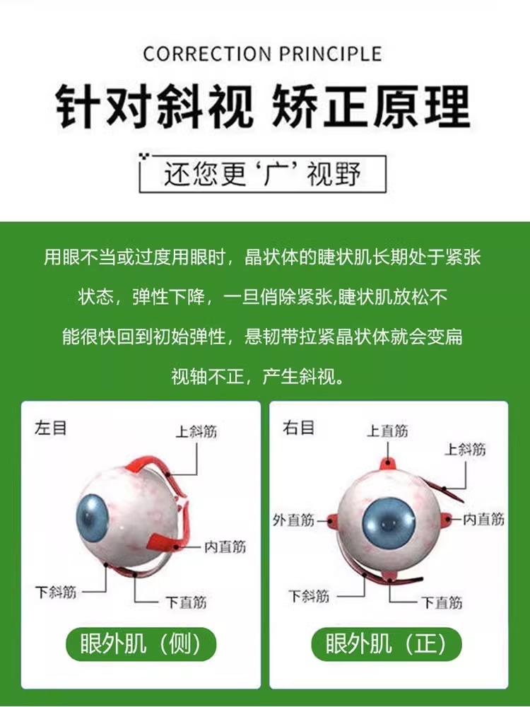 斜视矫正器训练器聚散球纠正眼睛内外斜视弱视斗鸡眼歪矫正眼斜贴 - 图2