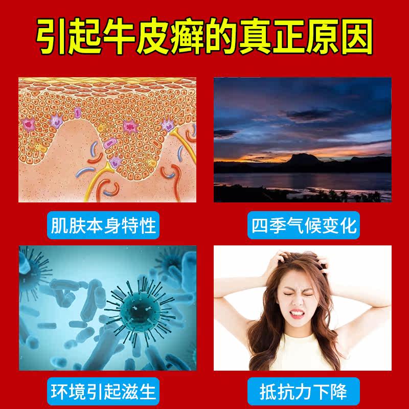 日本牛皮癣股癣手足癣膏药贴 顾仪保健理疗