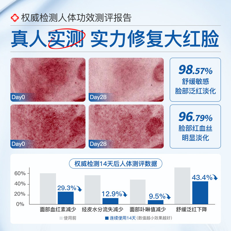 神经酰胺原液红血丝修复角质层薄增厚舒缓修护敏感肌护肤品精华