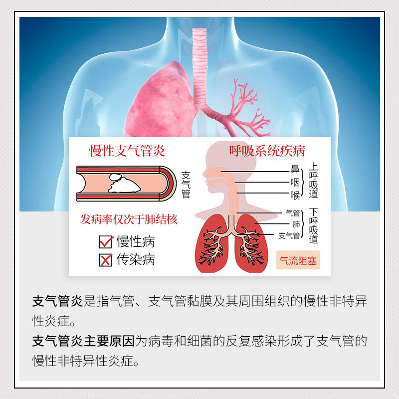 日本止咳贴儿童成人支气管炎中药膏 新驰医疗器械膏药贴（器械）