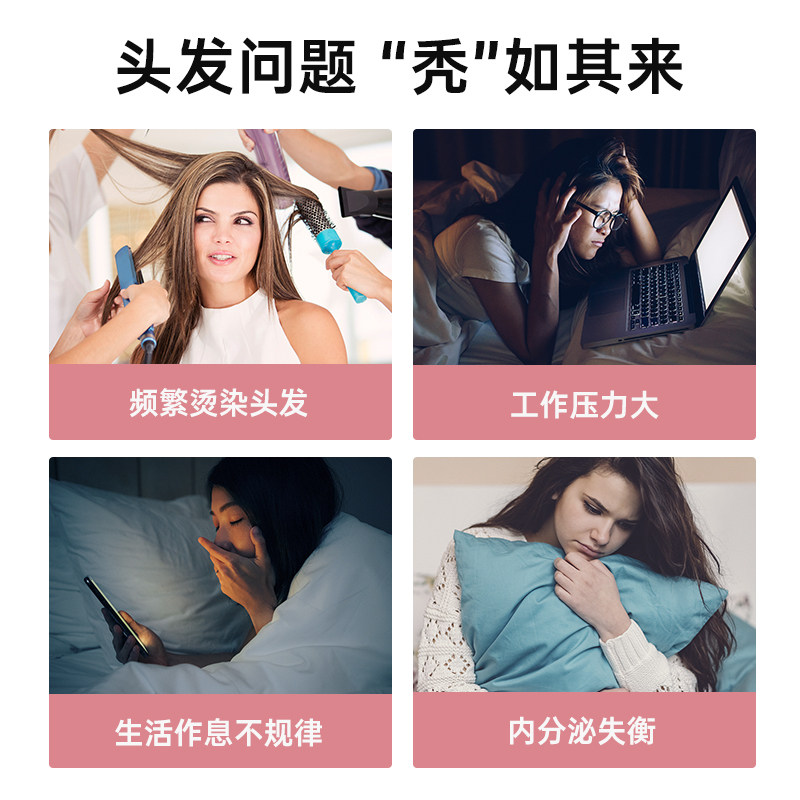  EGL海外丽人海外膳补