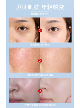 美容院同款玻尿酸水光精华补水