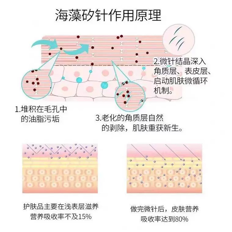 海绵微针套盒小绿膜收缩毛孔美容院专用海藻矽针痘痘印蓝精灵微晶