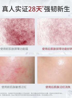 5100舒缓保湿修护喷雾敏感肌褪红