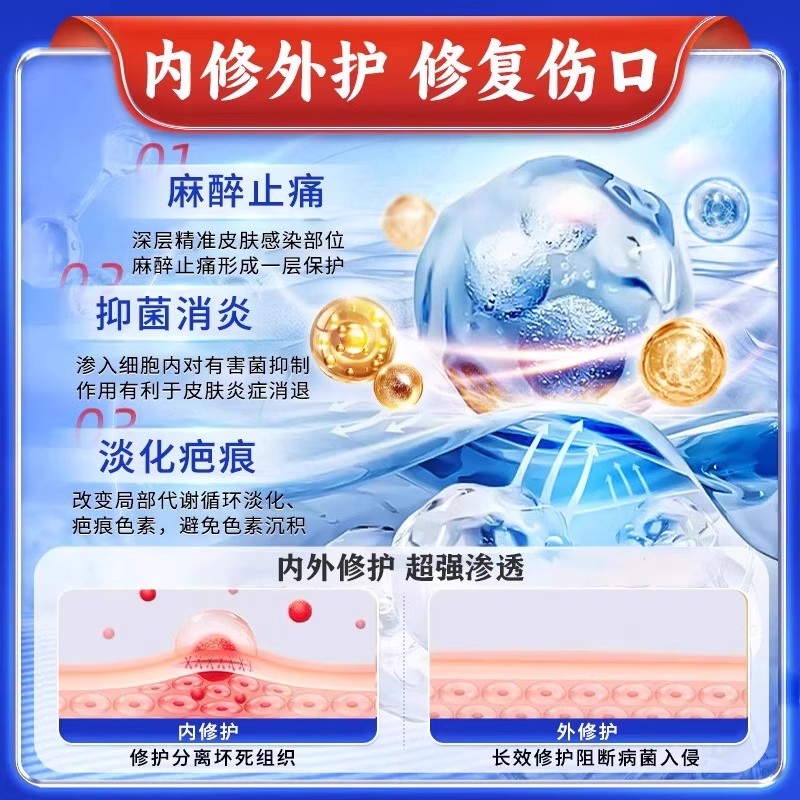 麻药外敷脸部医用麻醉药止痛膏皮肤局部麻醉点痣纹绣纹眉身专用WM - 图2