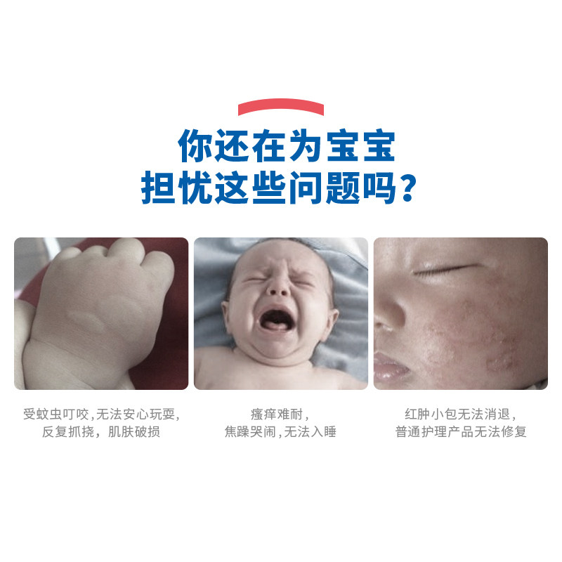 本护紫草膏宝宝蚊虫叮咬止痒止痒膏 本护止痒膏