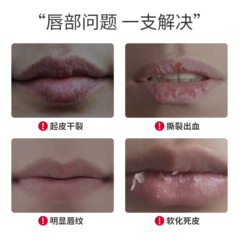 凡士林润唇膏男士男款专用保湿滋润补水防干裂润官方正品旗舰店女