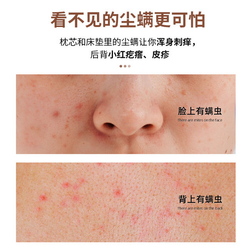 除螨喷雾官方旗舰店螨虫杀菌剂床上去螨虫神器可家用学生宿舍专用 - 图0