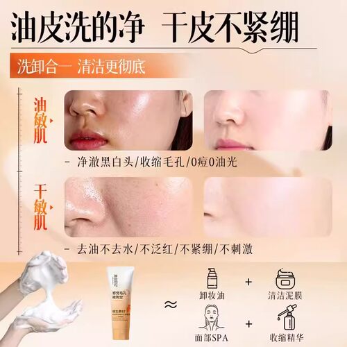 离岛日记维生素B7氨基酸洗面奶去黑头粉刺收缩毛孔清洁控油旗舰店 - 图1