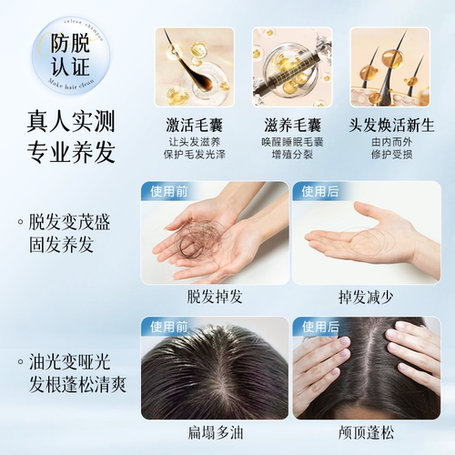 黛格娜洗发水防脱控油带代戴黛各个戈格哪拿呐那娜官方旗舰店正品 - 图3