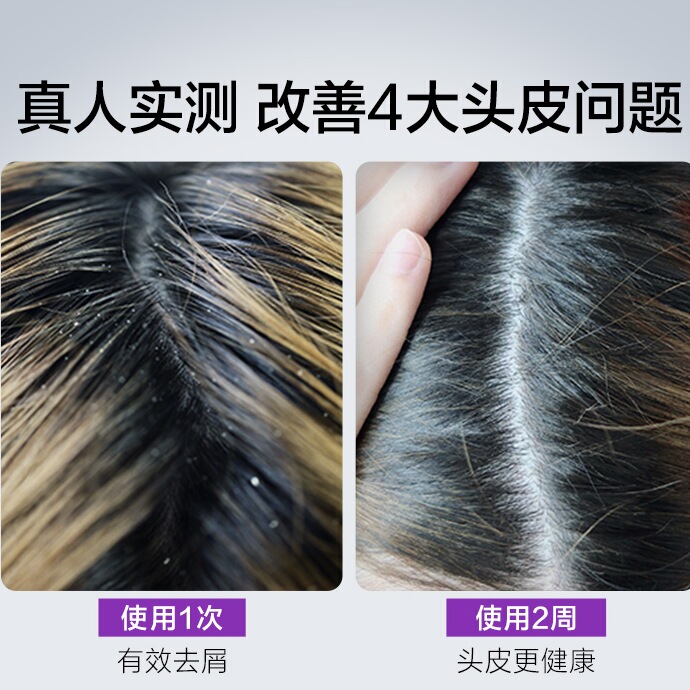 【直播专享】澳洲赛逸SHEVEU洗发水二硫化硒去屑控油清爽止痒紫*3