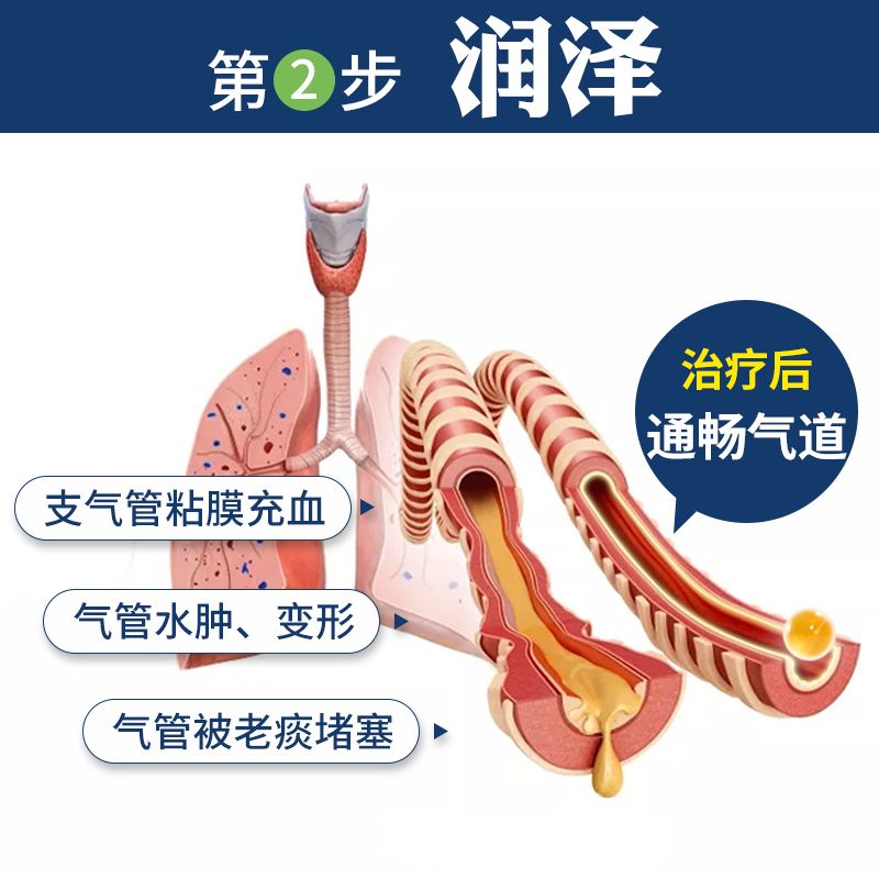 小医生牛尾蒿油软胶囊气急慢性支气管炎痰多黄稠胸闷气喘高油鲁抗 - 图2