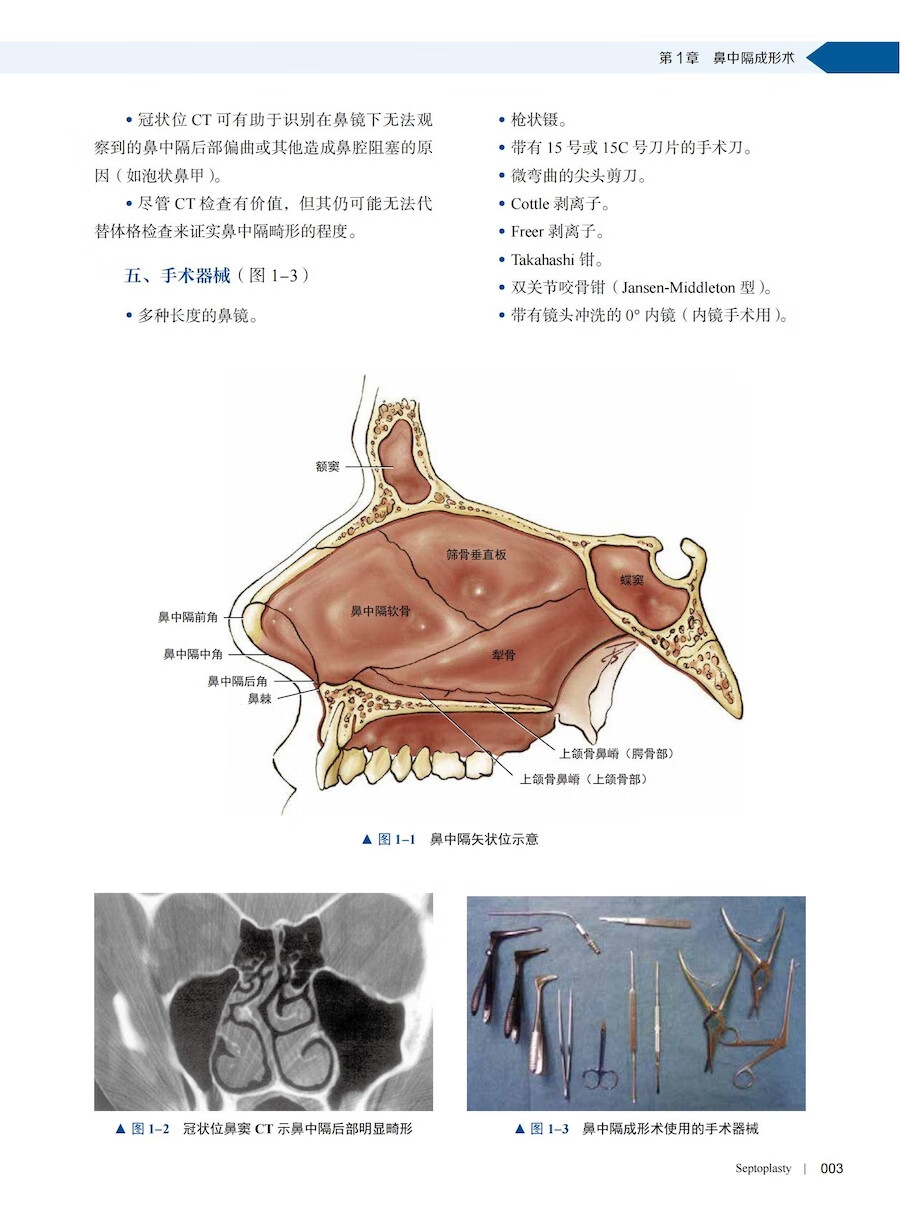 鼻内镜鼻窦颅底手术图谱（原书第2版）国际经典神经外科学译著[美]亚历山大·G.邱中国科学技术出版社-图2