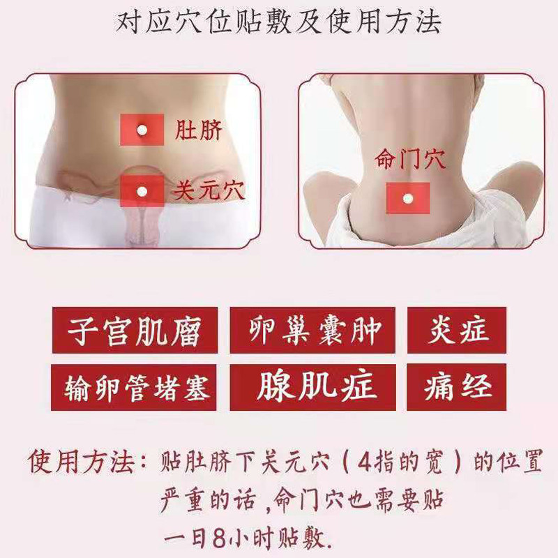 子宫肌瘤中药贴痛经腹痛 琳佑祥医疗器械膏药贴（器械）