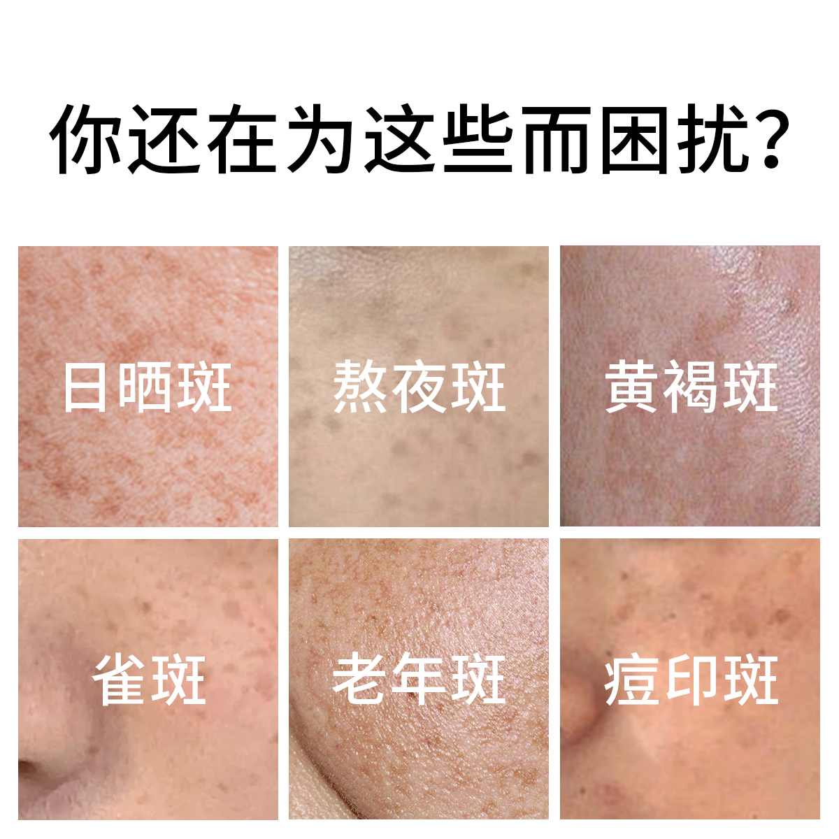 德国淡斑霜亮美白肌肤雀斑黄褐斑老年斑色斑淡斑霜大白罐保湿面霜