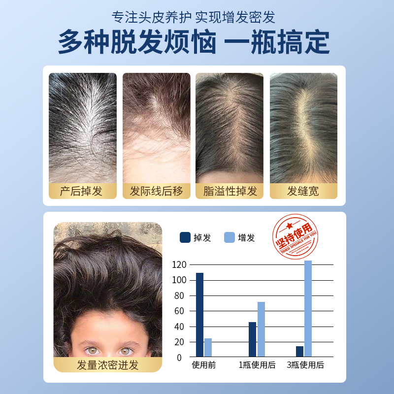 Newmo育发液女生增发防脱密发生营养发际线头皮精华官方旗舰店发