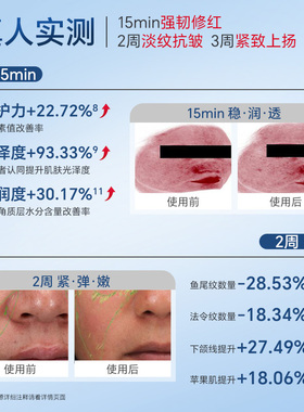 ZQII再启抗皱次抛修护保湿精华液