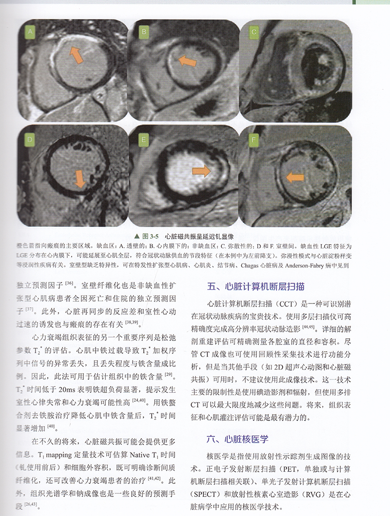 现货正版全新心力衰竭病理生理学与临床管理综合指南唐其柱主译中国科学技术出版社9787504689801-图3