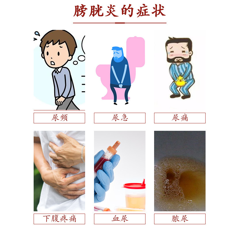 尿路感染男女疼痛中药膏 晟耀保健理疗