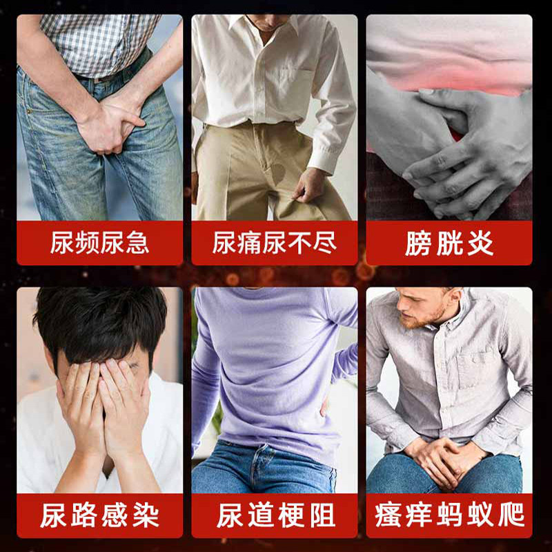 尿道炎女尿路感染男膀胱炎贴尿频贴 维诺特保健理疗