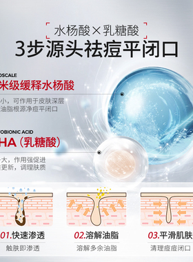 【医研级爽肤水】抚平熬夜闭口痘
